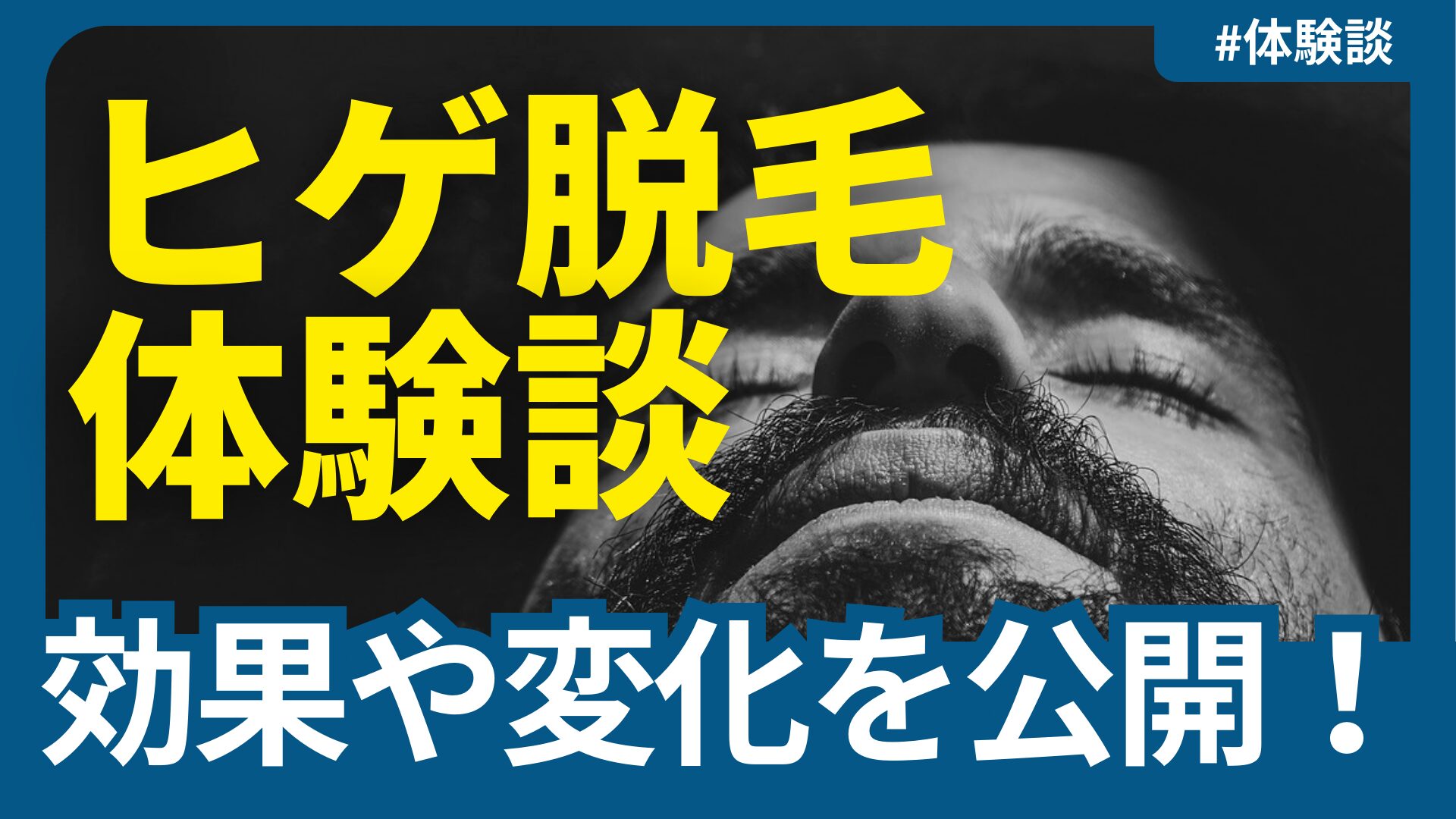 ヒゲ脱毛体験談
