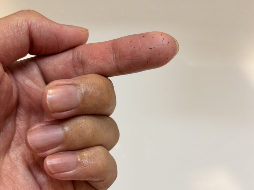 It seems that the beard hair removal period has come