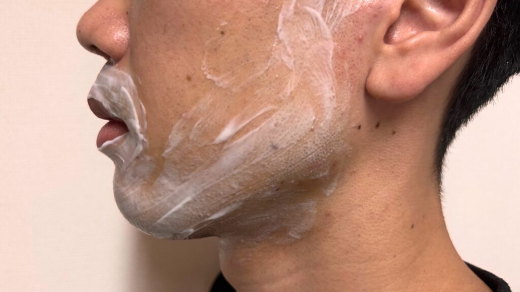 Anesthetic cream applied