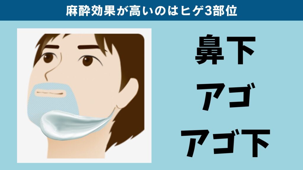 The three areas of the beard where anesthetic cream is most effective