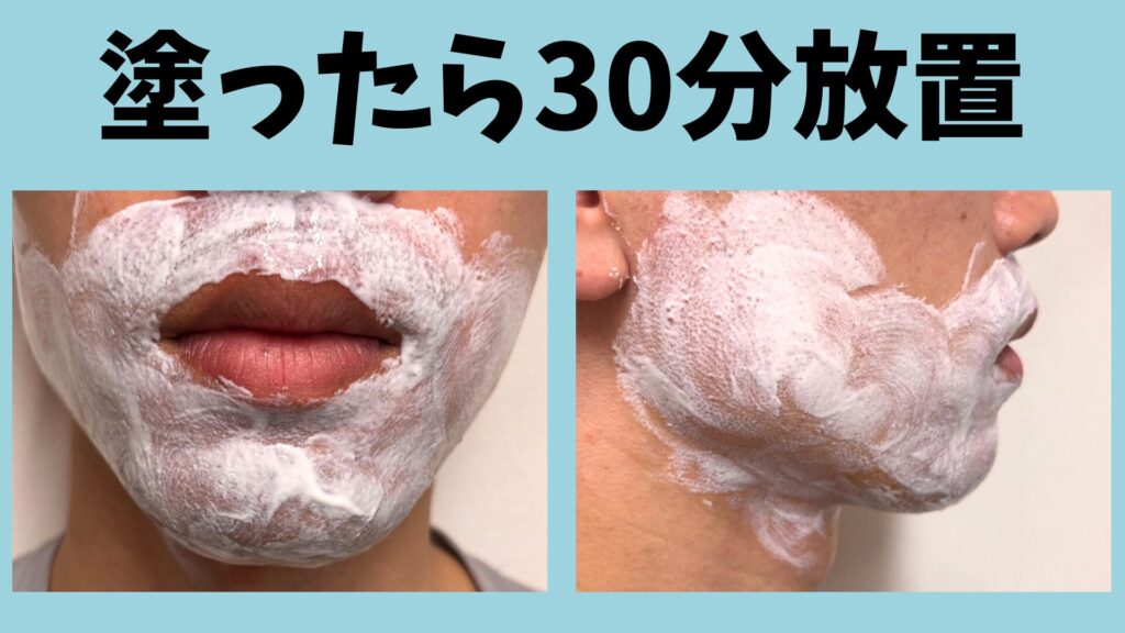 The procedure for using the anesthetic cream is to apply it and leave it on for at least 30 minutes.