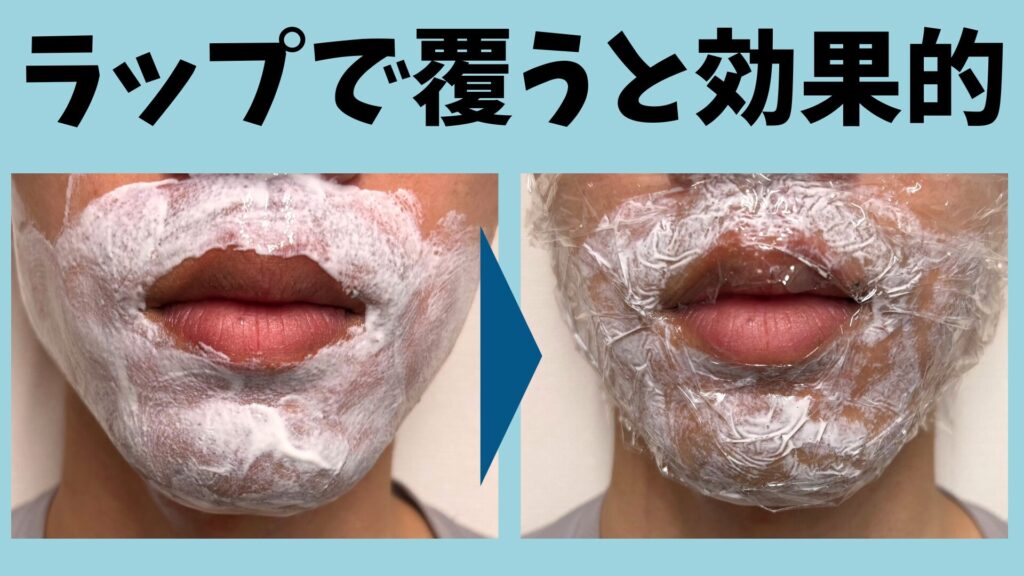 After applying anesthetic cream, the area to be treated is covered with plastic wrap.