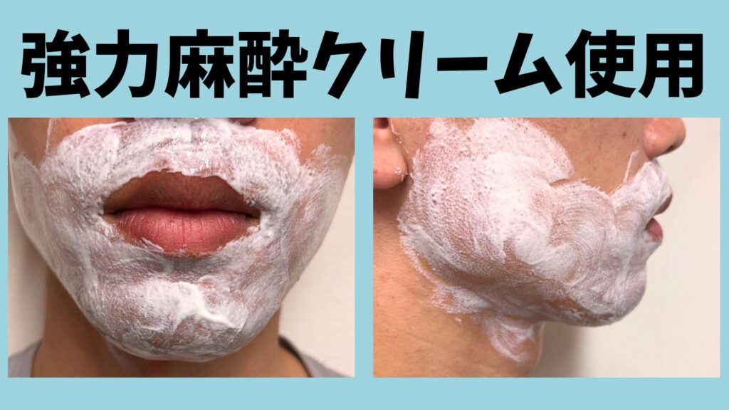 Applying Shonan Beauty Clinic's powerful anesthetic cream