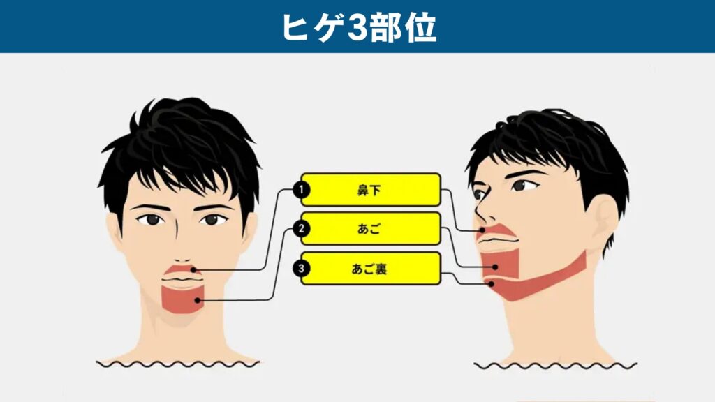 Irradiation range for 3 beard hair removal areas