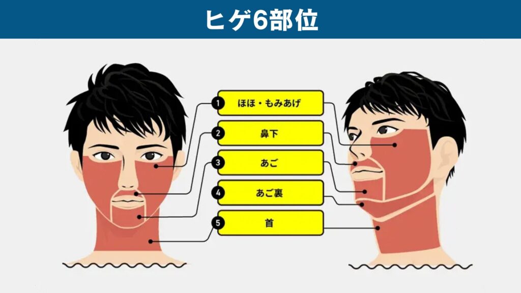 Irradiation range for 6 beard hair removal areas