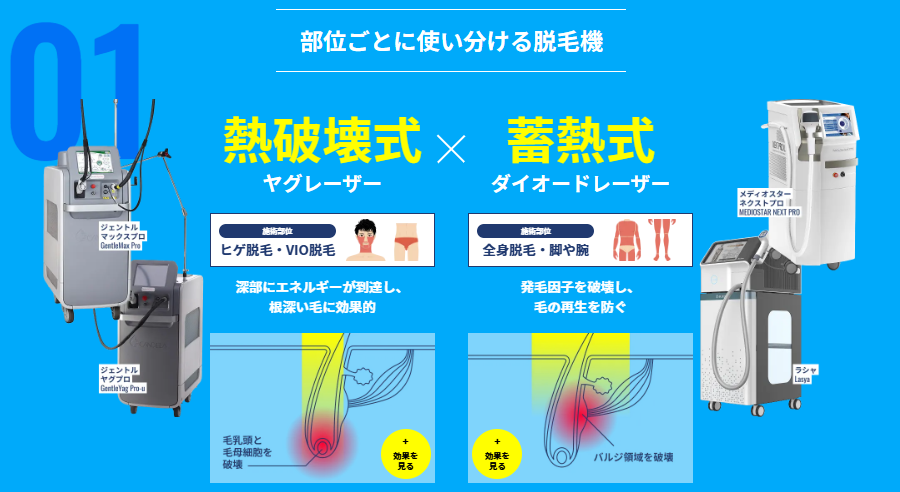 Men's Rize hair removal device