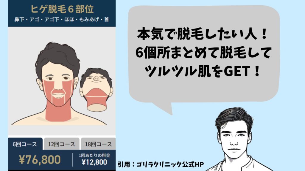 Gorilla Clinic's 6-area beard hair removal plan explanation