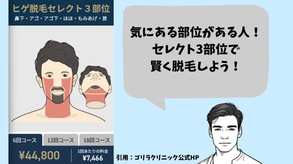 Gorilla Clinic's beard hair removal select 3-area plan explanation