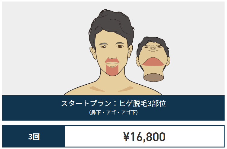 Gorilla Clinic Dogenzaka trial course