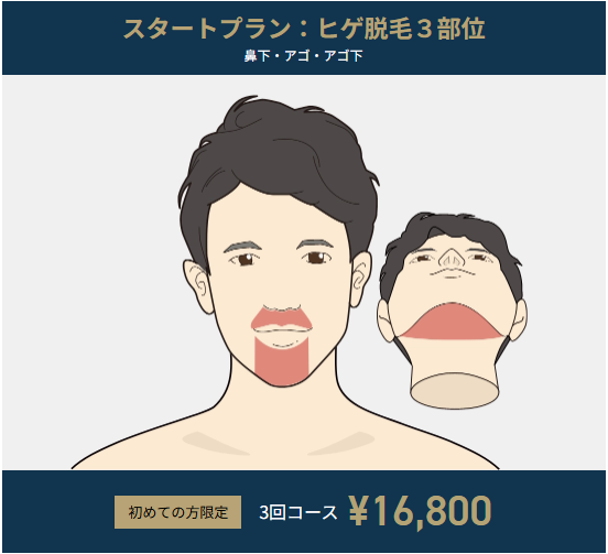 Gorilla Clinic Beard Hair Removal Start Plan