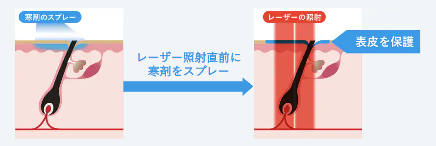 Cooling system details