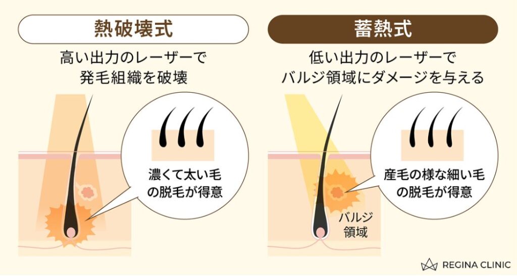 熱破壊式と蓄熱式レーザーの違いを示す図解