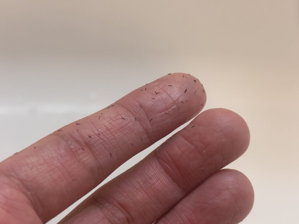 ヒゲ脱毛後にヒゲが抜け落ちる様子