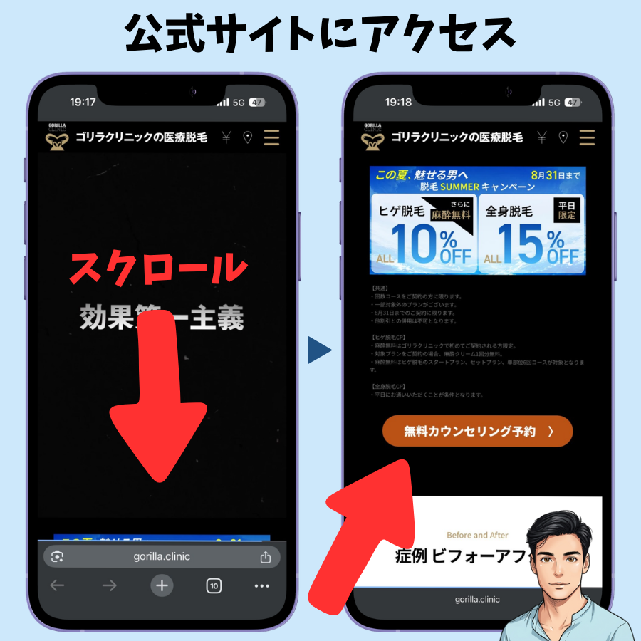 ゴリラクリニック公式サイトを下にスクロールして無料カウンセリング予約ボタンをタップする画面