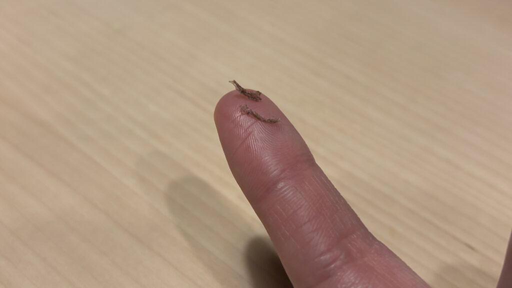 指先にのった、はがれ落ちたシミのかさぶた