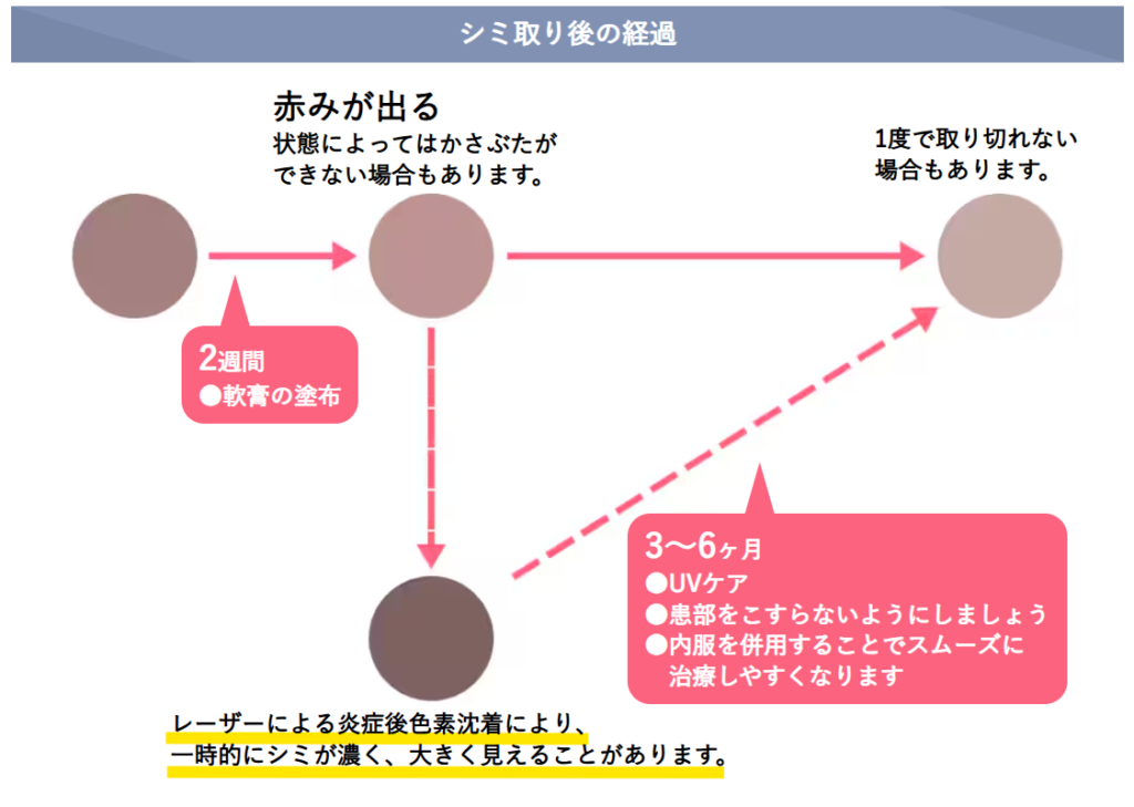シミ取り後の経過を示した図。赤みが出たあと軟膏を2週間塗り、3〜6か月のUVケアで落ち着いていく流れ
