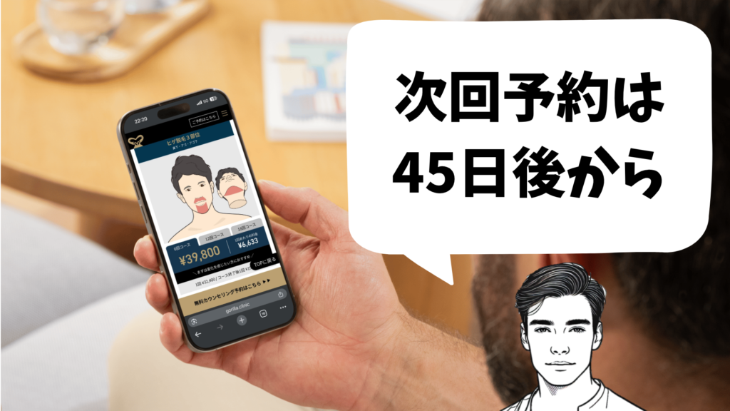 ゴリラクリニックのヒゲ脱毛は次の照射まで45日あける必要があることを示した図解