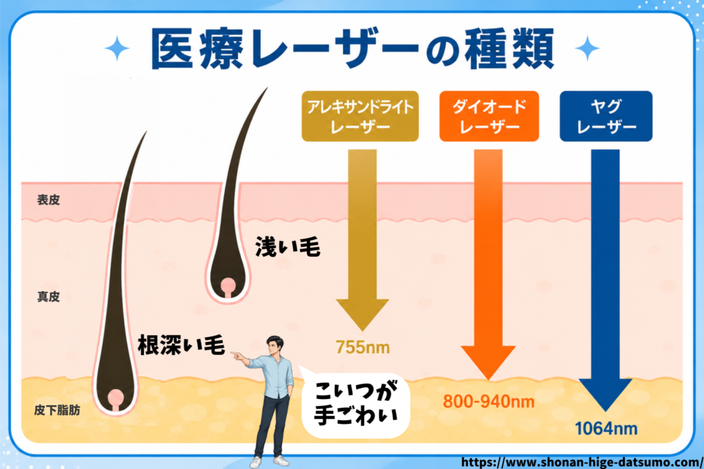 レーザーの種類について解説した図