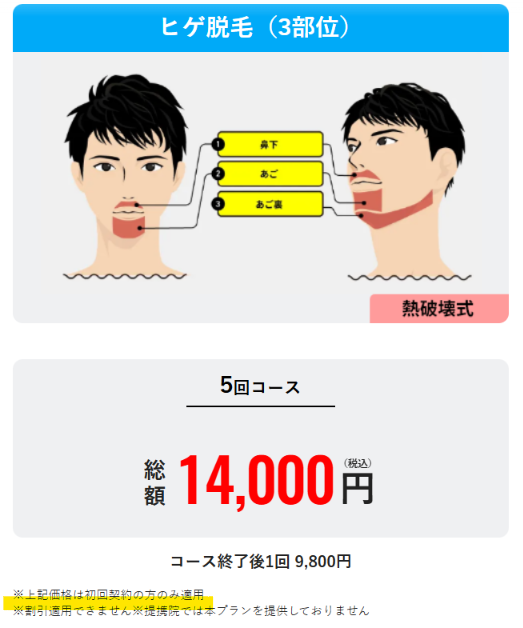 メンズリゼのヒゲ脱毛3部位5回14,000円の料金（初回契約のみ・コース終了後1回9,800円）