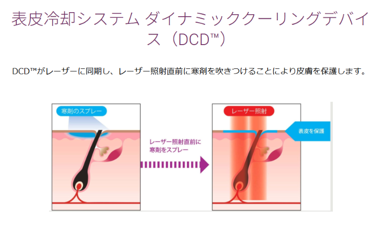 ジェントルマックスプロの冷却装置DCDのしくみ