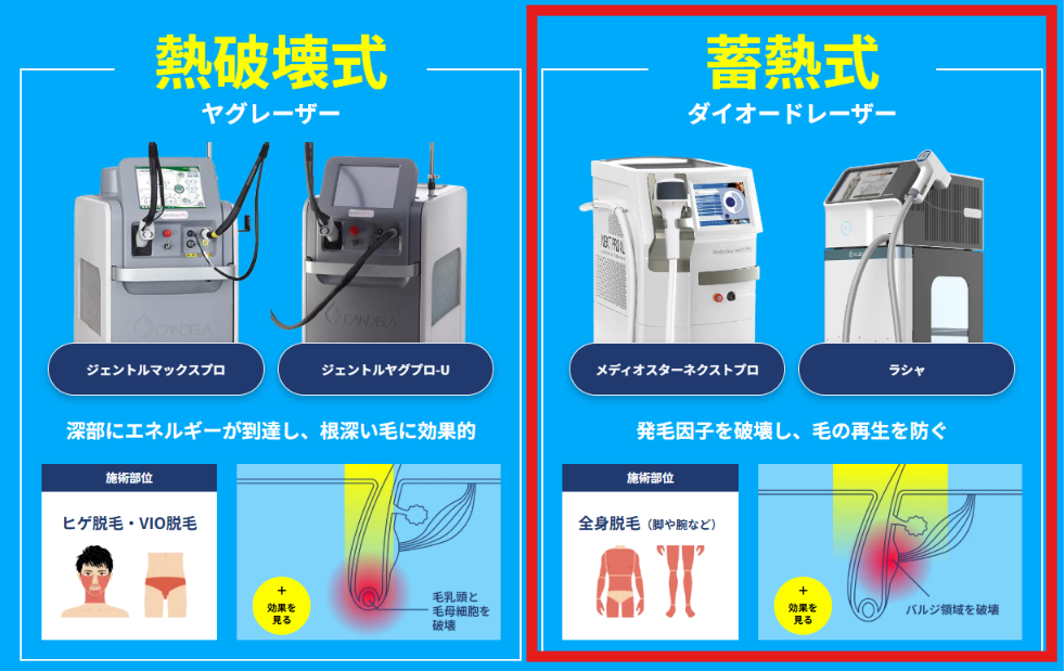 医療脱毛クリニックの熱破壊式ヤグレーザーと蓄熱式ダイオードレーザーの比較