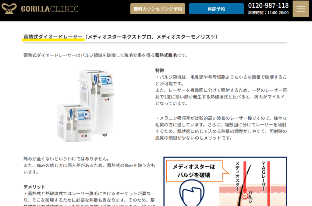 ゴリラクリニック公式サイトの蓄熱式ダイオードレーザーの説明