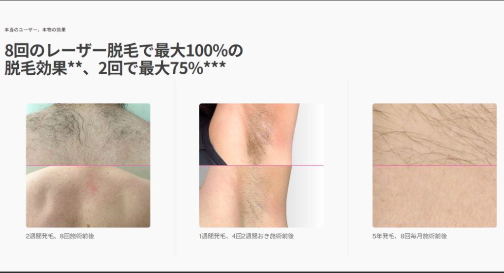 8回で最大100%・2回で最大75%の脱毛効果を示すトリア公式サイトの画面