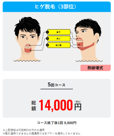 メンズリゼのヒゲ脱毛3部位5回コースが総額14,000円と記載された公式サイトの料金表