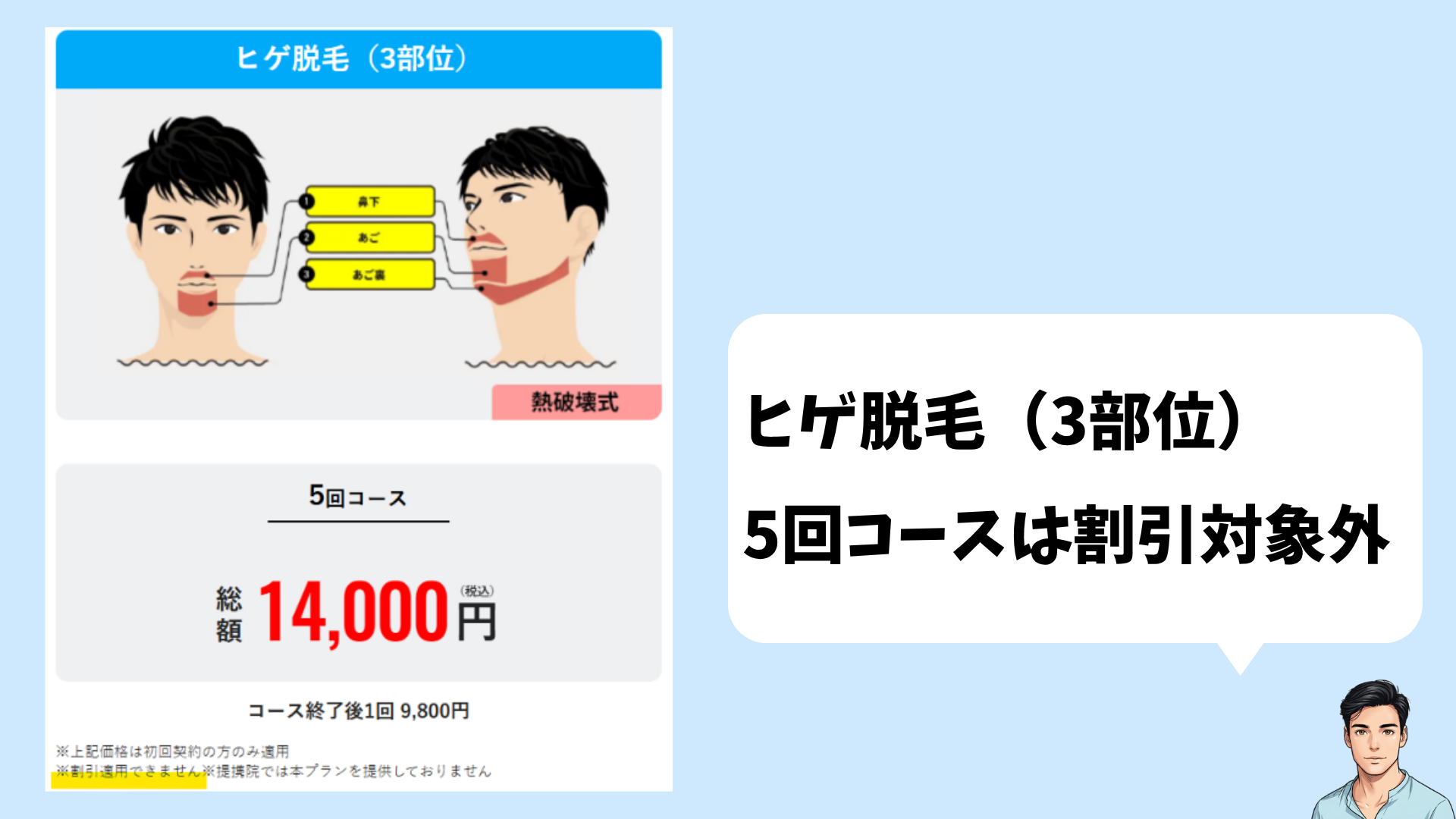 ヒゲ脱毛3部位5回プランが割引の適用外であることを示した図