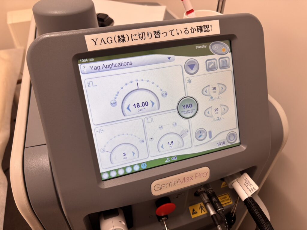 ジェントルマックスプロの操作画面。ヤグレーザー1064nm・出力18.00J/cm²の設定