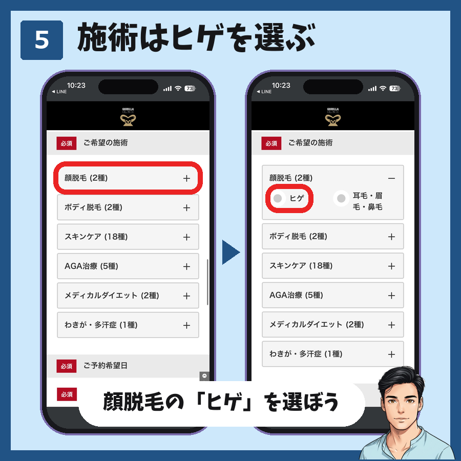 LINE予約で施術の顔脱毛を開いてヒゲを選ぶ手順の図解