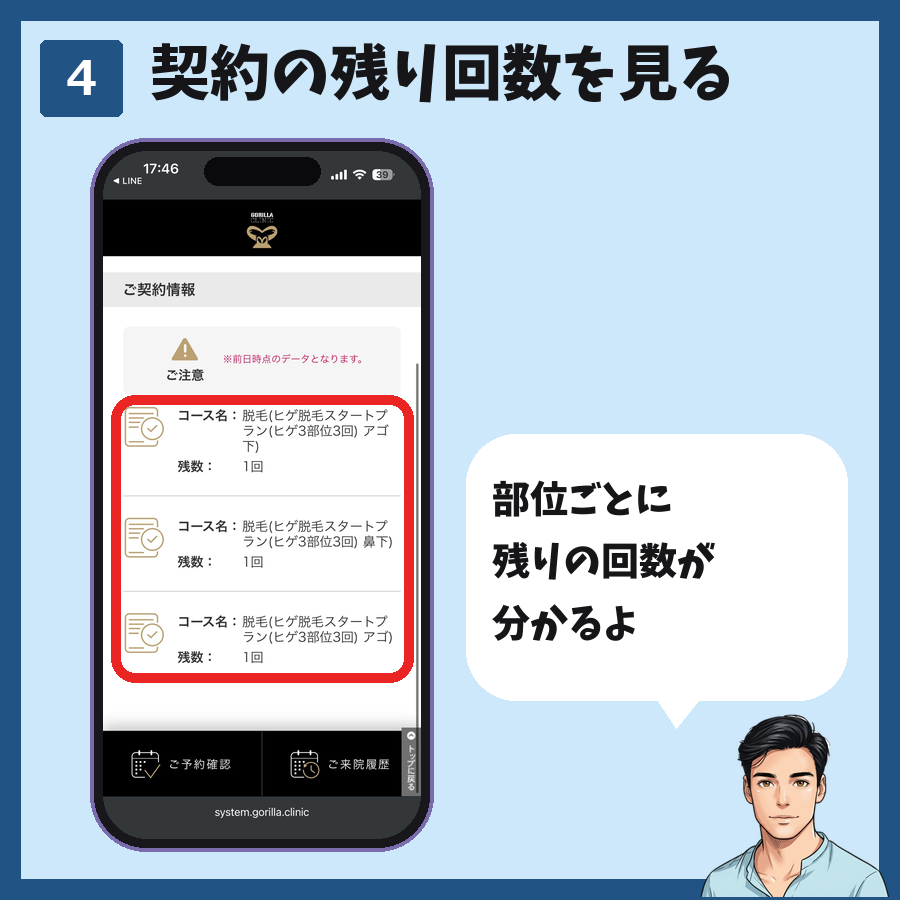 ゴリラクリニックのLINEのマイページのご契約情報。ヒゲ脱毛スタートプランの鼻下・アゴ・アゴ下ごとに残数1回と表示される図解