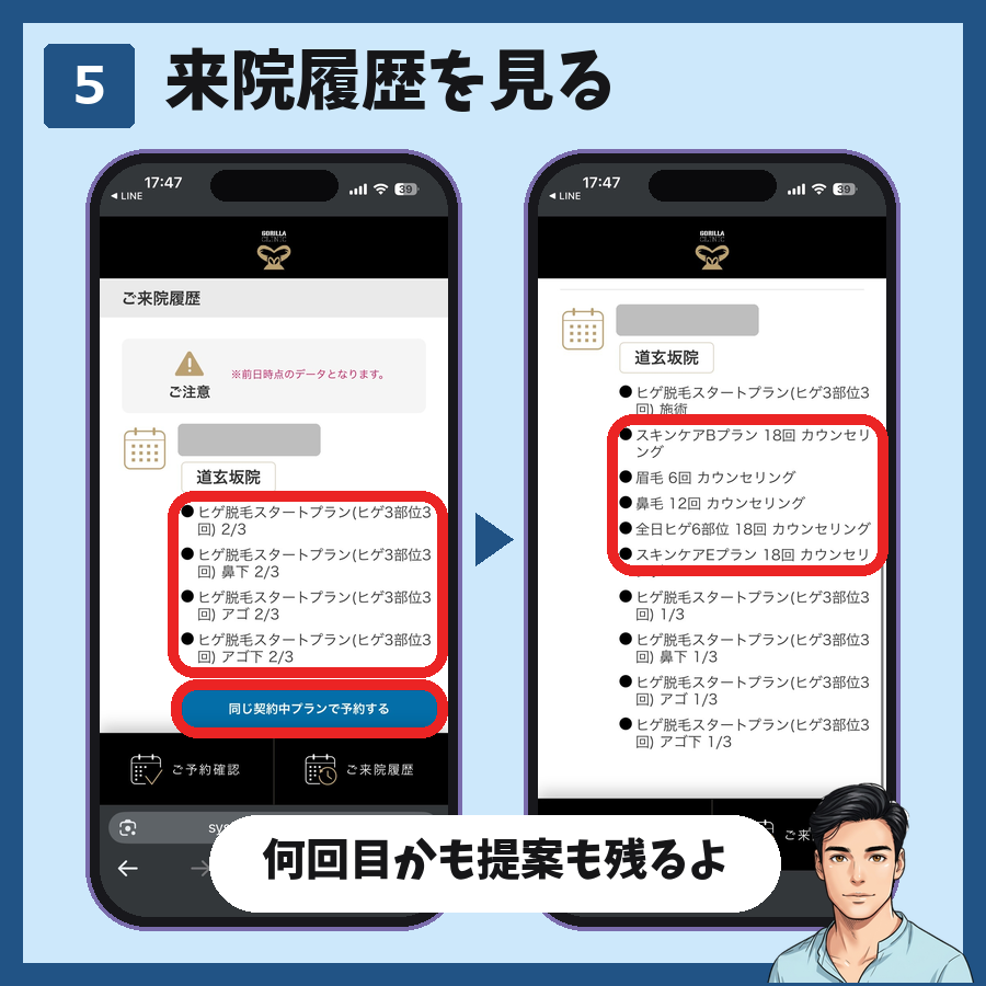 ゴリラクリニックのLINEのマイページのご来院履歴。照射ごとに2/3のような回数と、カウンセリングで提案されたプランが残る図解