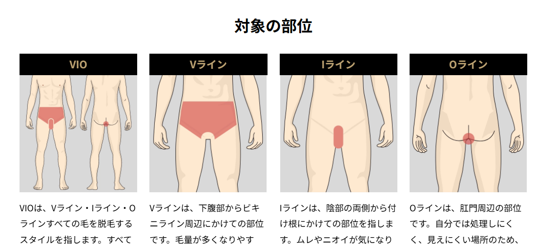 ゴリラクリニック公式サイトのVIO脱毛の対象部位。Vライン・Iライン・Oラインの範囲の図