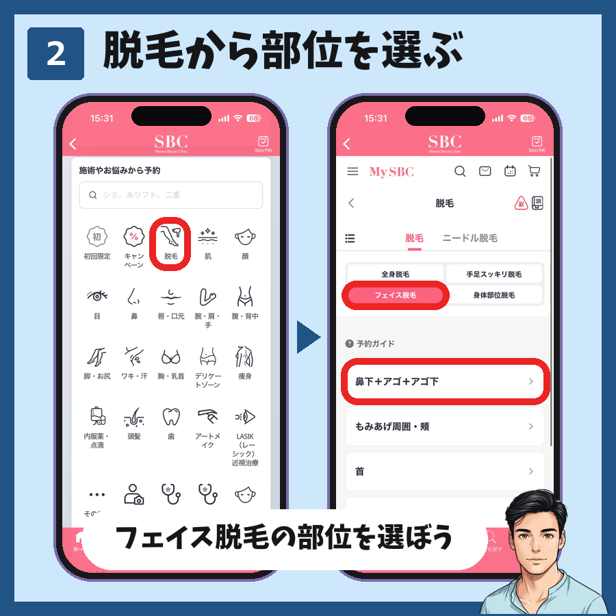 MySBCの「施術やお悩みから予約」で脱毛を選び、フェイス脱毛の鼻下+アゴ+アゴ下を選ぶ手順