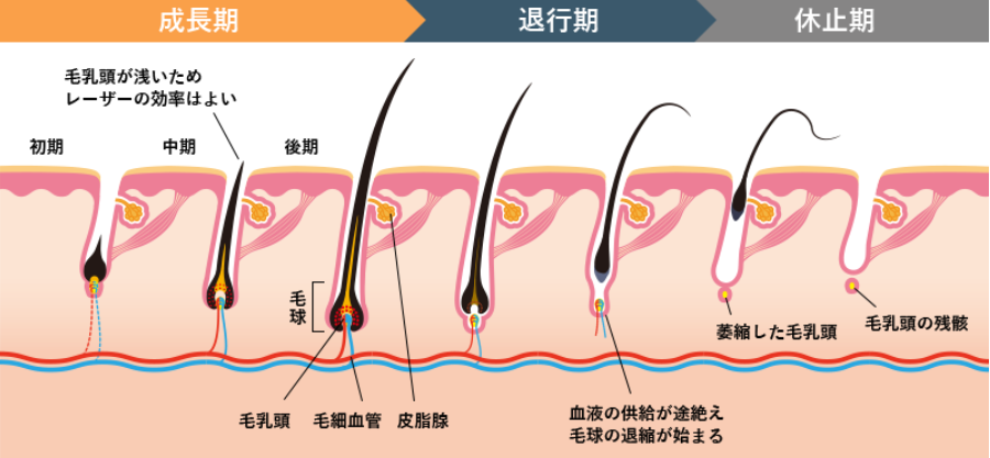 毛周期の図。成長期・退行期・休止期の毛の状態