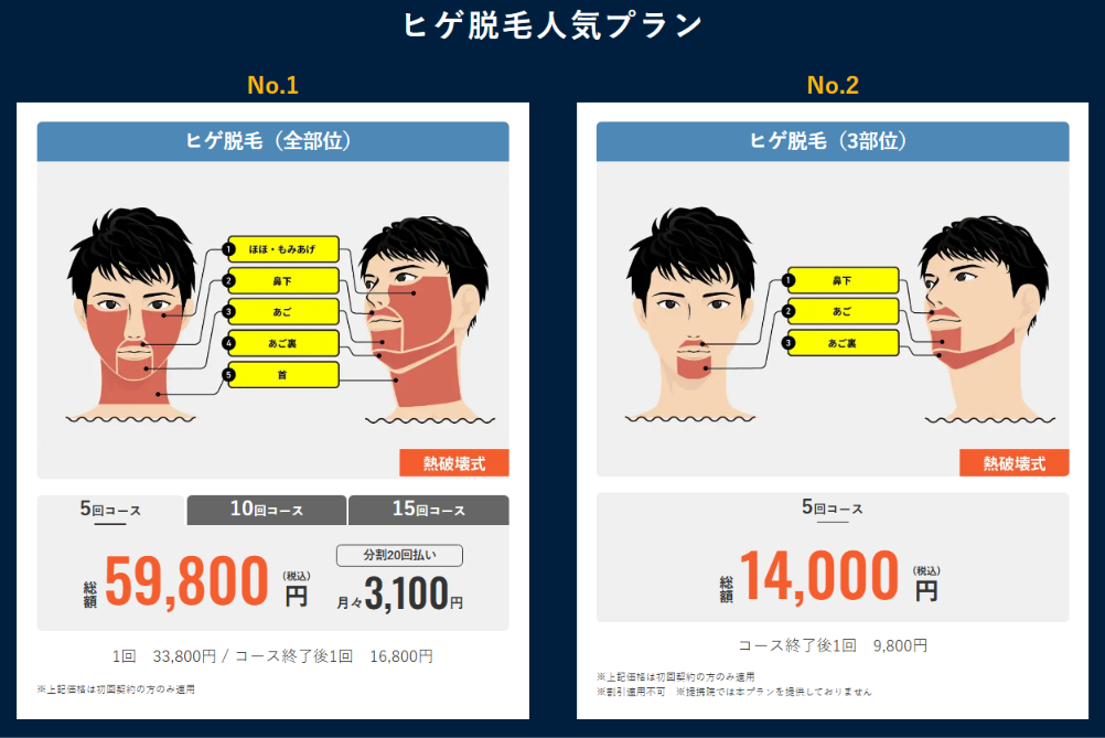 メンズリゼ公式サイトのヒゲ脱毛人気プラン(全部位5回59,800円・3部位5回14,000円)