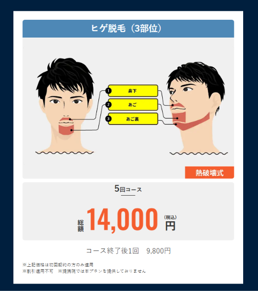 メンズリゼ公式サイトのヒゲ脱毛3部位5回14,000円のプラン