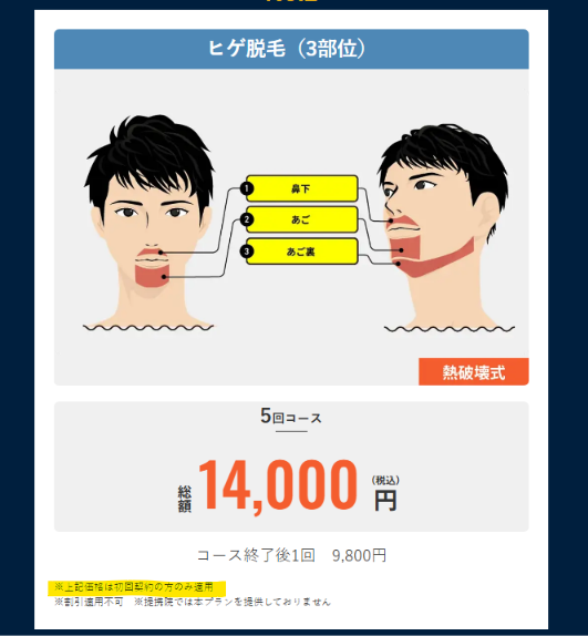 初回契約の方のみ適用と記載されたメンズリゼのヒゲ脱毛3部位5回14,000円の料金表
