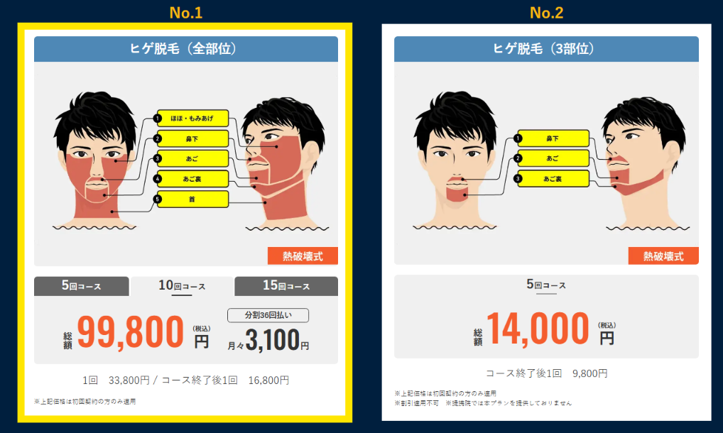 メンズリゼのヒゲ脱毛人気プラン（全部位10回99,800円と3部位5回14,000円）