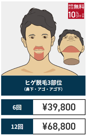 ゴリラクリニック公式サイトのヒゲ脱毛3部位の料金。6回39,800円・12回68,800円
