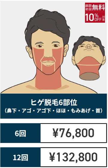 ゴリラクリニック公式サイトのヒゲ脱毛6部位の料金。6回76,800円・12回132,800円