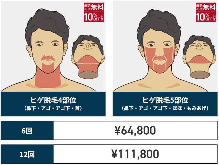 ゴリラクリニック公式サイトのヒゲ脱毛4部位と5部位の料金。6回64,800円・12回111,800円