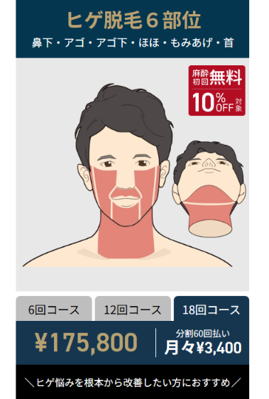 ゴリラクリニック公式サイトのヒゲ脱毛6部位18回コースの料金。175,800円で月々3,400円の分割払い
