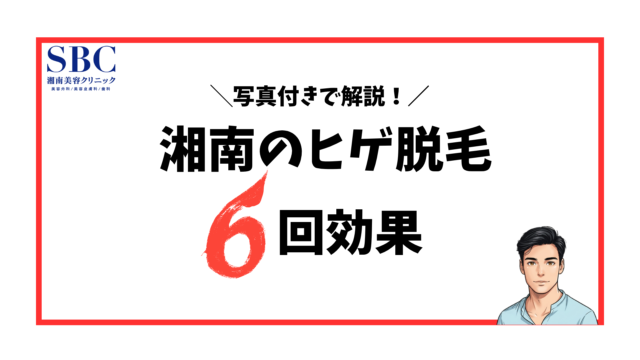 湘南美容クリニック-ヒゲ脱毛6回の効果